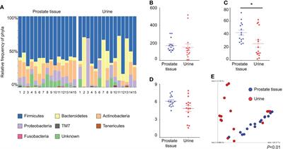 Localization and potential role of prostate microbiota